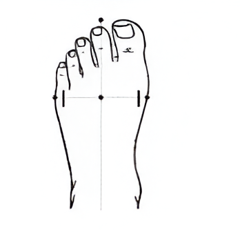 Wide forefoot shape