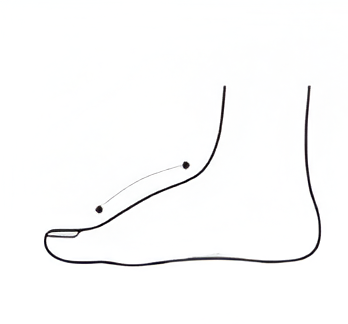 High instep foot shape